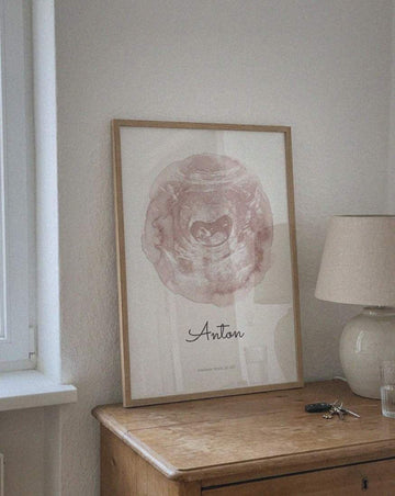 Beispielfoto: Ultraschallbild – Zarter Farbklecks