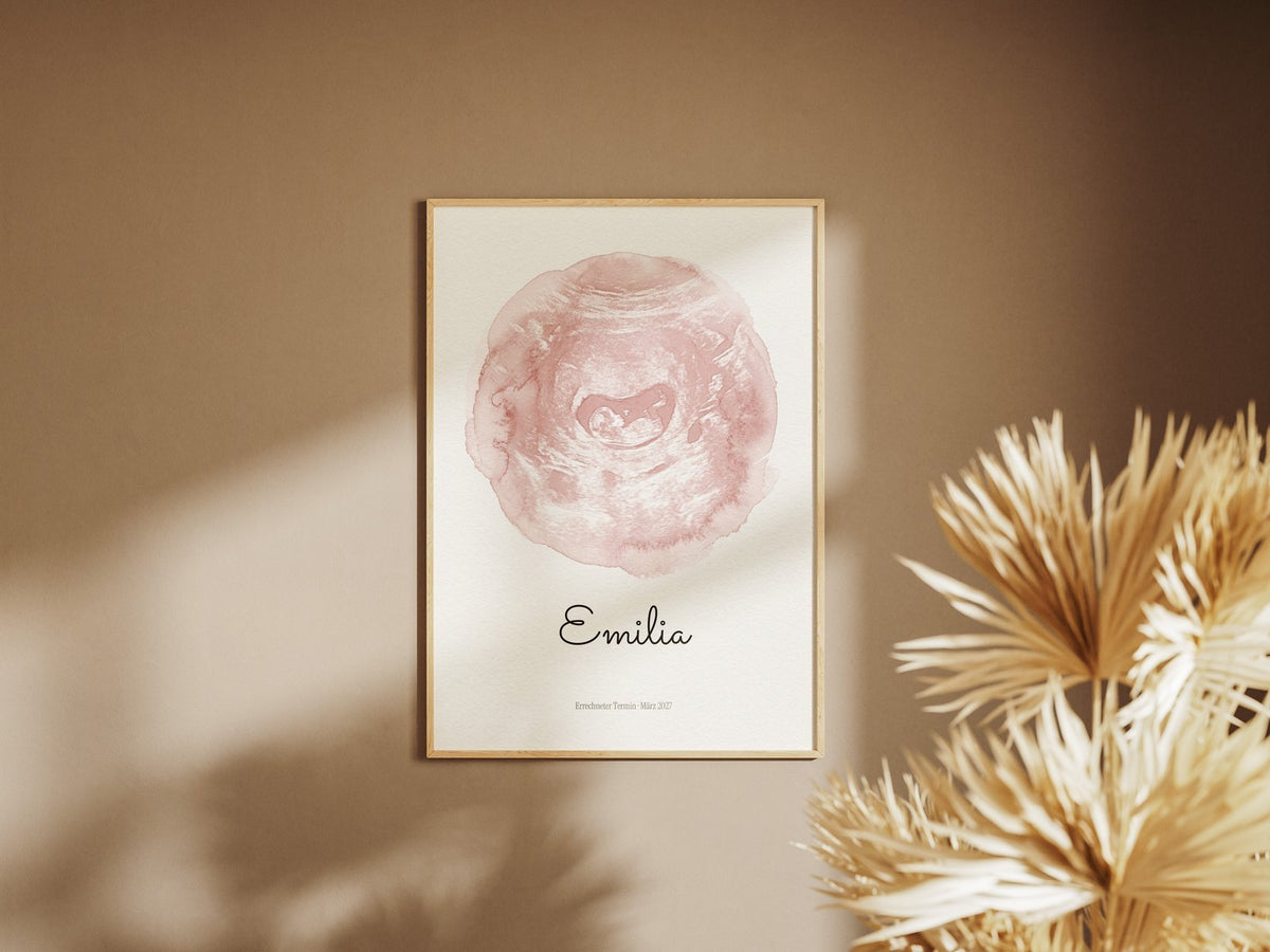 Ultraschallbild – Zarter Farbklecks – gerahmtes Poster an der Wand